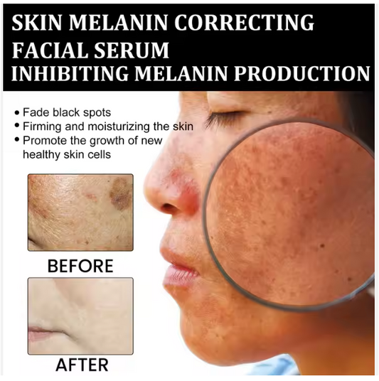 Eelhoe Skin Correcting Serum