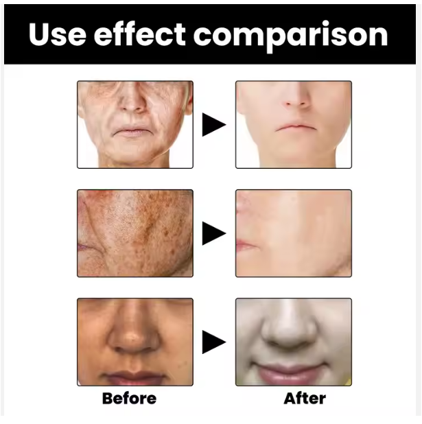 Eelhoe Skin Correcting Serum