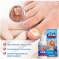 Sumifun™ Nail Fungus Treatment