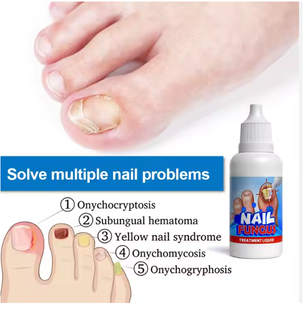 Sumifun™ Nail Fungus Treatment
