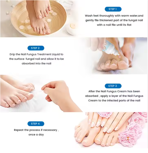 Sumifun™ Nail Fungus Treatment