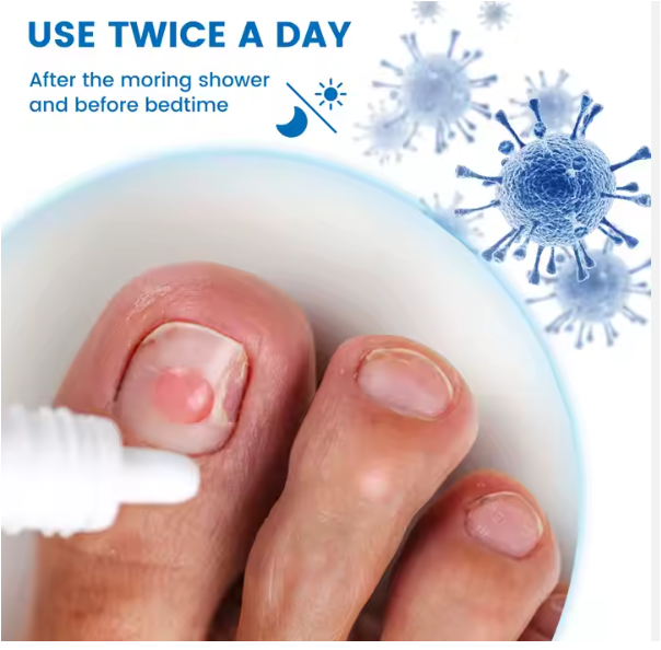 Sumifun™ Nail Fungus Treatment