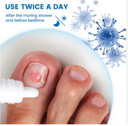 Sumifun™ Nail Fungus Treatment